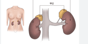 부신기능 저하증 원인 검사 자연 치료