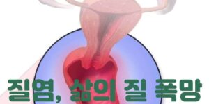 질염 질통증