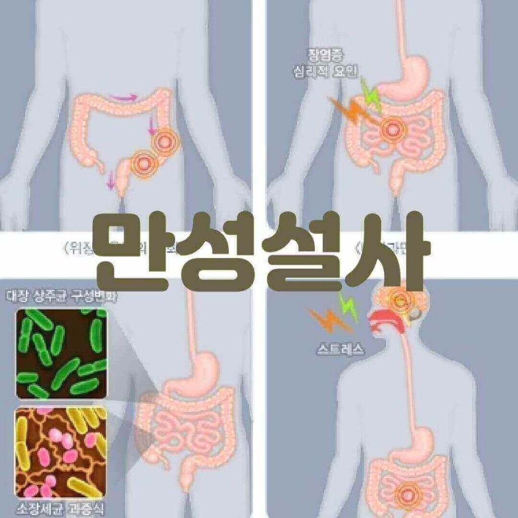 만성 설사 환자를 위한 식단 조절법