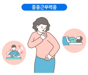 중증 근무력증 환자를 위한 자연치료법