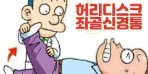 좌골신경통 허리디스크 치료 운동하는 방법