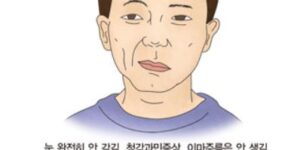 안면 마비