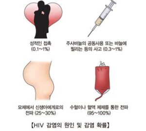 HIV 바이러스 감염