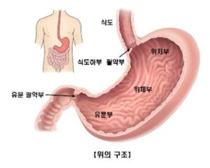 위염 통증