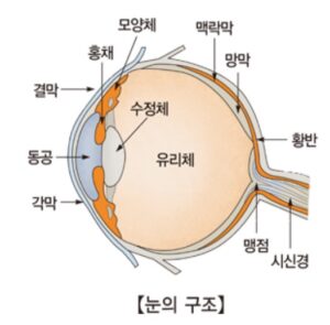 알레르기성 결막염