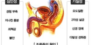 조루증 원인 진단 고치는 법 개선 자가 치료 비수술