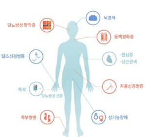 제 2형 당뇨병