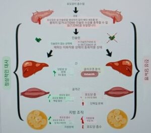 인슐린 비의존성 당뇨병