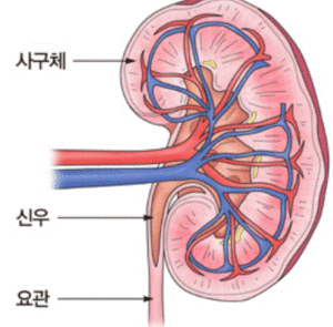 요독증