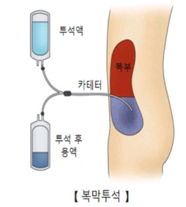 요독증