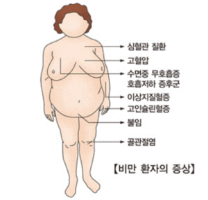 비만